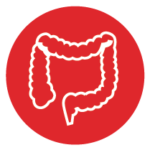 colon-rectal-cancer